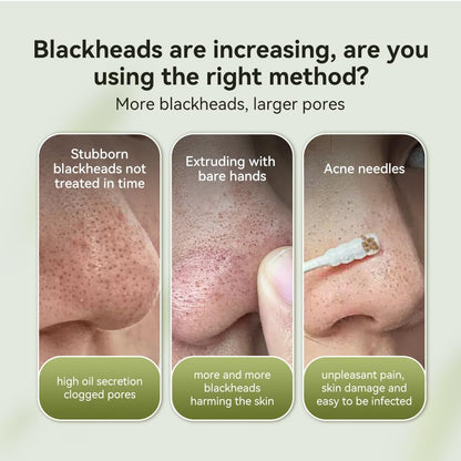 LANBENA Blackhead Mask