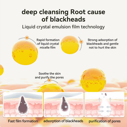 LANBENA Blackhead Mask