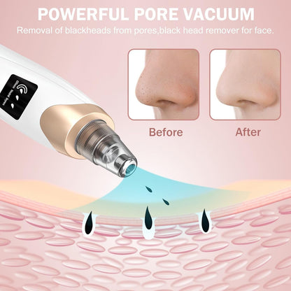 Blackhead Remover Pore Vacuum Kit